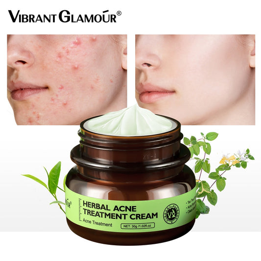 VIBRANT GLAMOUR Herbal Acne Treatment Cream Skin Care 30g