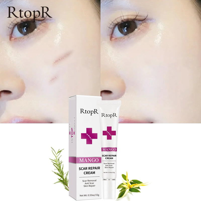 Scar Repair Cream