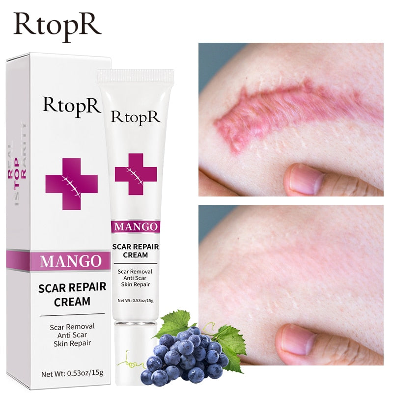 Scar Repair Cream